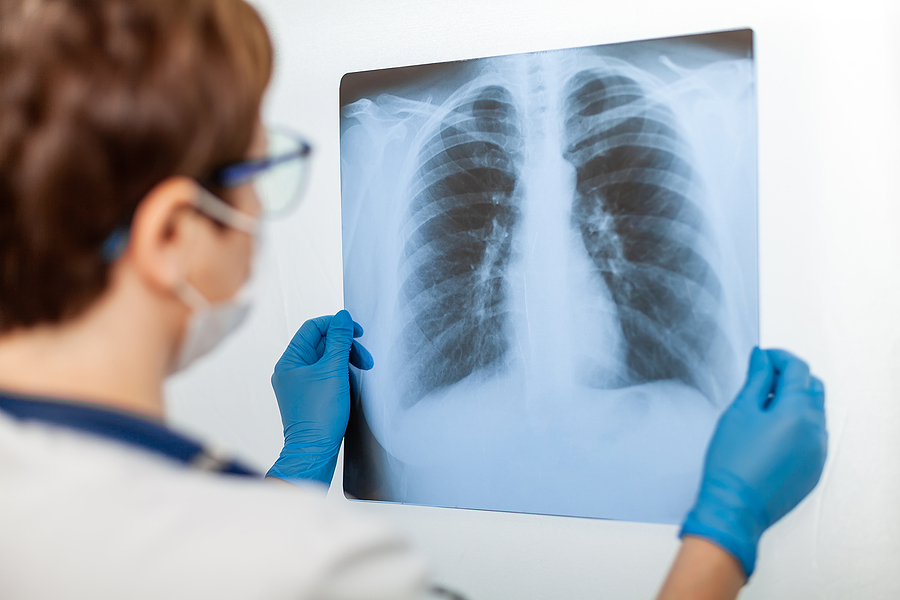 Doctor looking at x-ray.